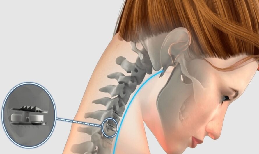 Cervical Disc Replacement Surgery Cost in India