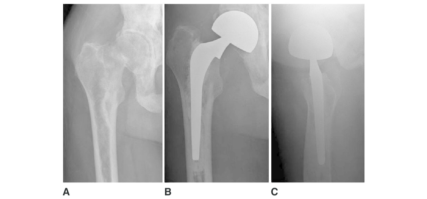 Pre-operative and Post-operative Care