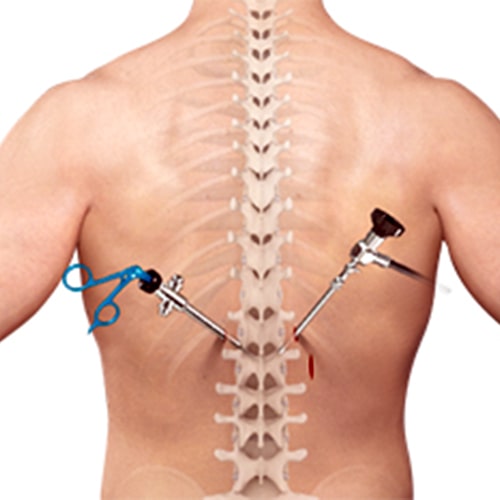 Outcomes of Spine Surgery in Older Adults