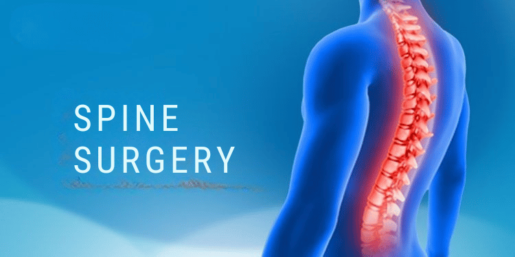 When Is Spine Surgery Necessary? Signs and Symptoms to Watch Out For