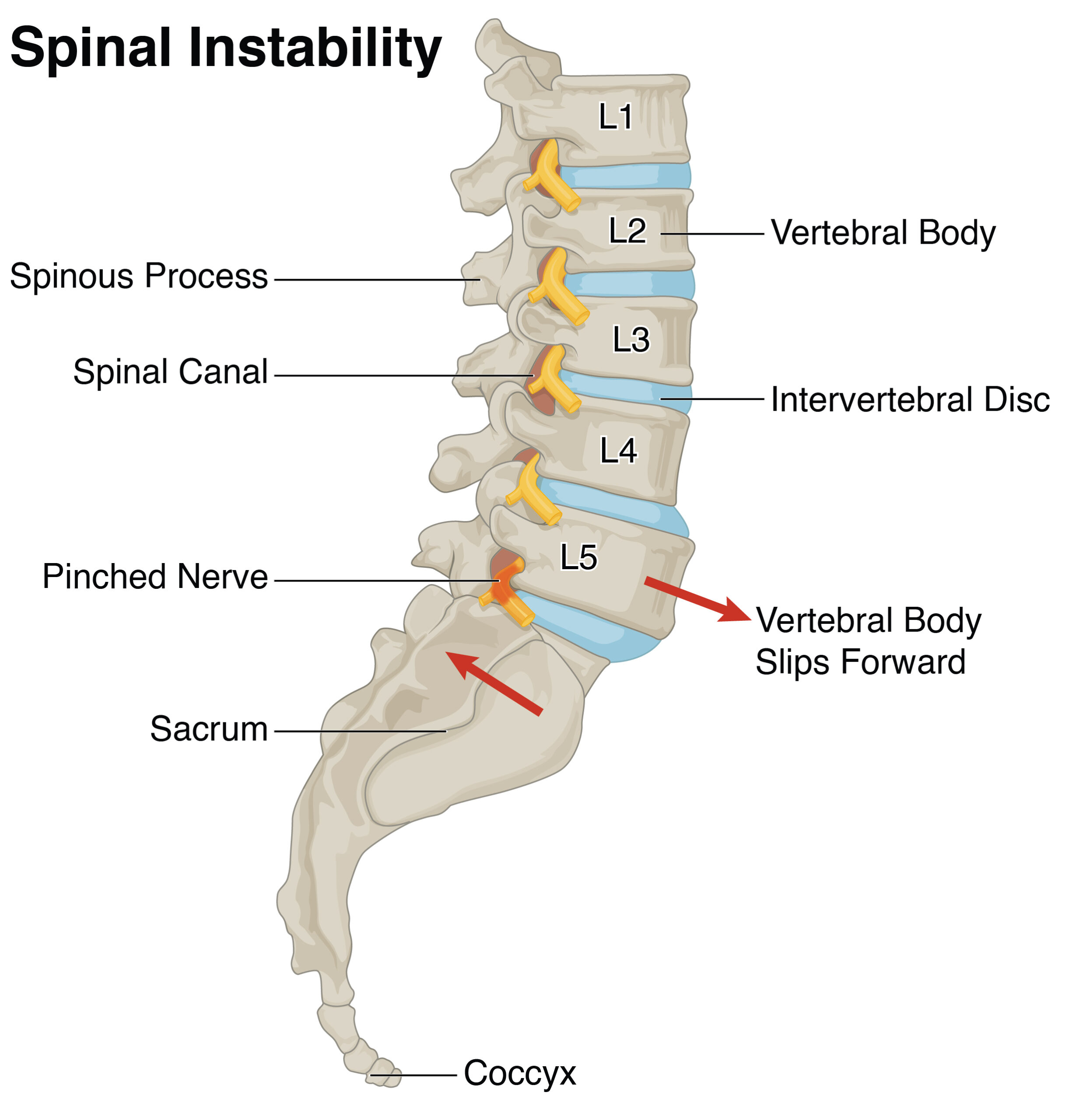 Spinal Instability