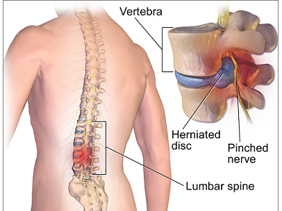 What is Spine Surgery?
