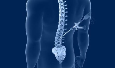 Spine Surgery and Pain Relief: How Effective is It in Treating Chronic Back Pain?
