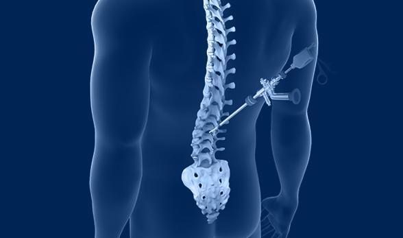 Spine Surgery and Pain Relief: How Effective is It in Treating Chronic Back Pain?