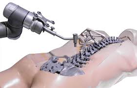 What Is Robotic-Assisted Spine Surgery?
