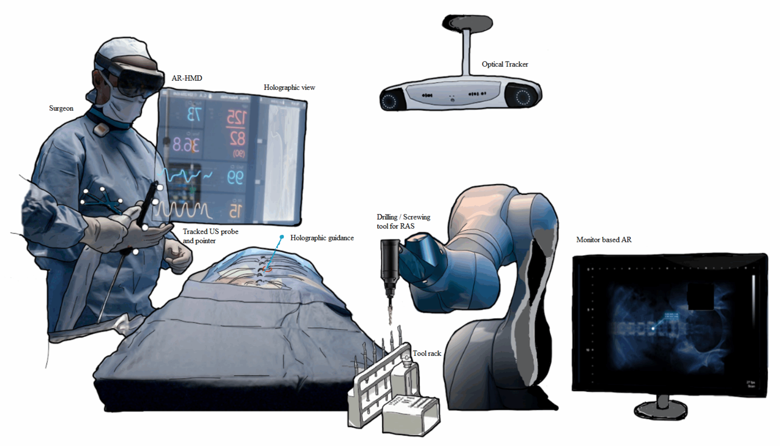 Benefits of Robotic-Assisted Spine Surgery